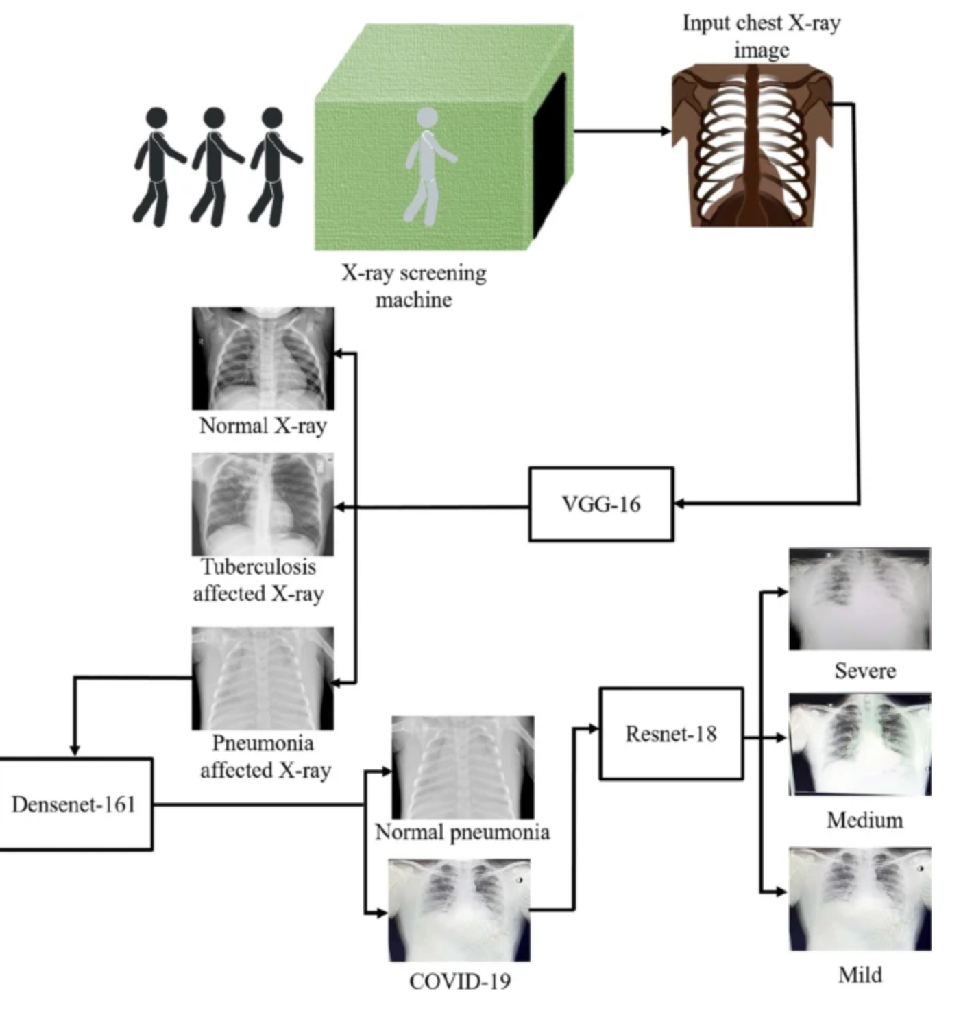 Pneumonia detection chest X-ray CNN